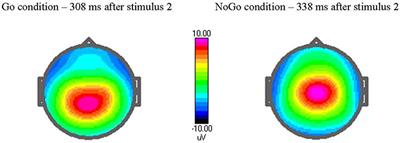 Event-Related Potentials in a Cued Go-NoGo Task Associated with Executive Functions in Adolescents with Autism Spectrum Disorder; A Case-Control Study